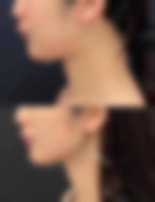 雷晓东医生口碑评价及反馈内容