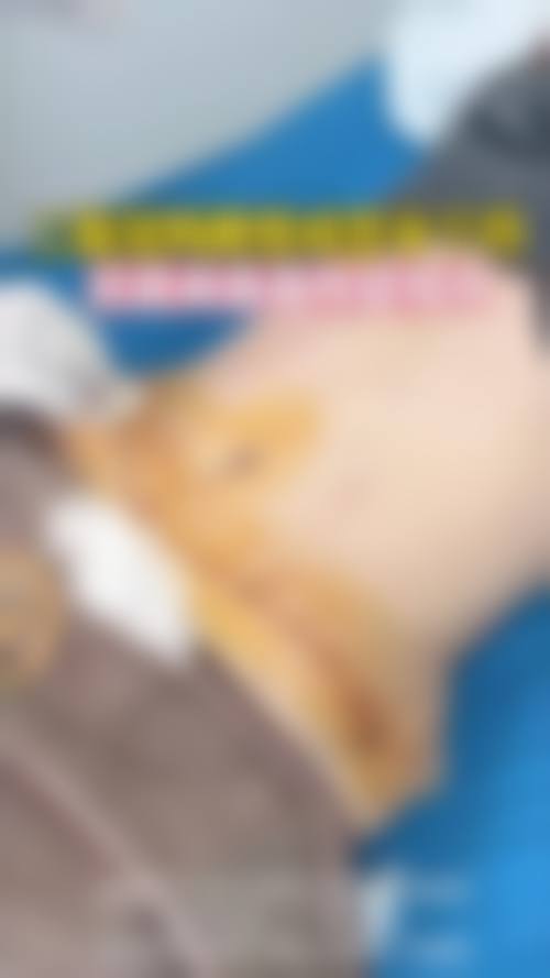 雷晓东医生技术优势