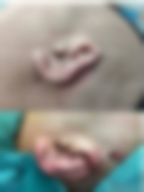 本溪中 心医院烧伤整形外科收费价格表