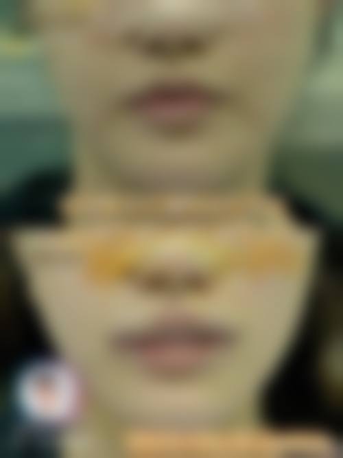 石期枫医生技术优势