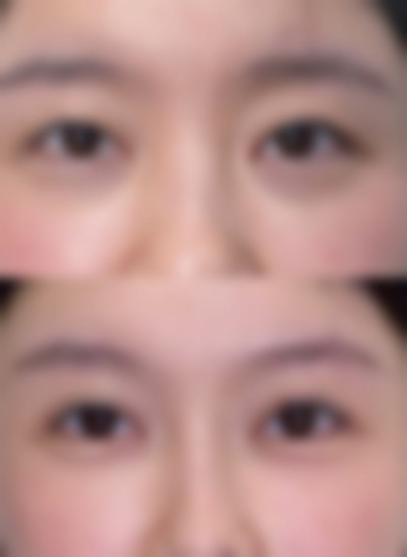 深圳仁爱医院植发中 心地址电话、营业时间