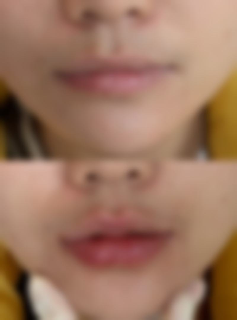 深圳仁爱医院植发中 心特色诊疗项目与技术优势