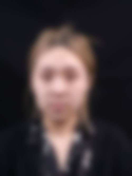 赵延峰医生预约挂号