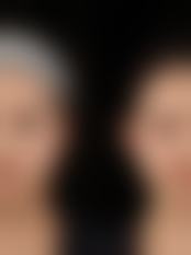 深圳奈瑞儿医疗美容门诊部预约挂号方式