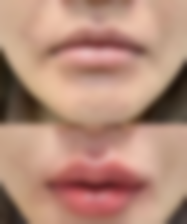 东南大学附属中大医院预约挂号方式