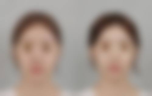 彭华伟（昆明医 科 大学第二附属医院）医生口碑评价及反馈内容