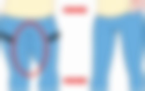 潘福强医生技术优势