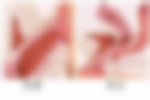 彭华伟（昆明医 科 大学第二附属医院）医生项目收费价格