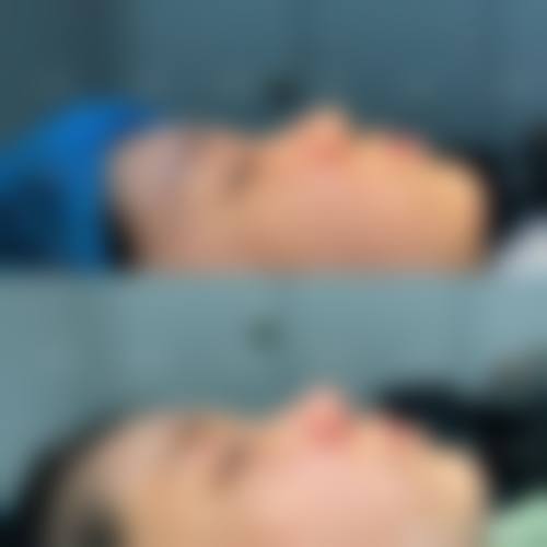 仁怀禾美星整形医院收费价格表