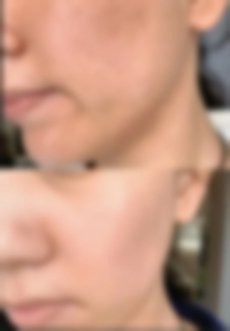 潘福强医生项目收费价格