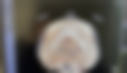 彭华伟（武汉国金可瑞医江汉新华路医疗美容科诊所）医生口碑评价及反馈内容