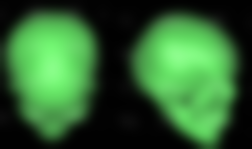 蔡巧玲医生技术优势