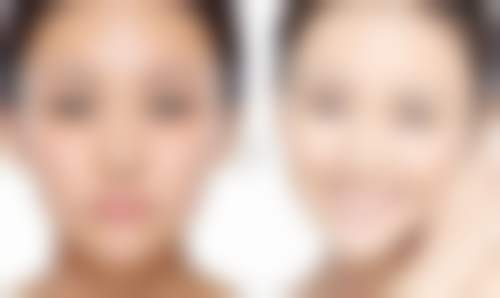 深圳宝安区人民医院医疗美容科特色诊疗项目与技术优势