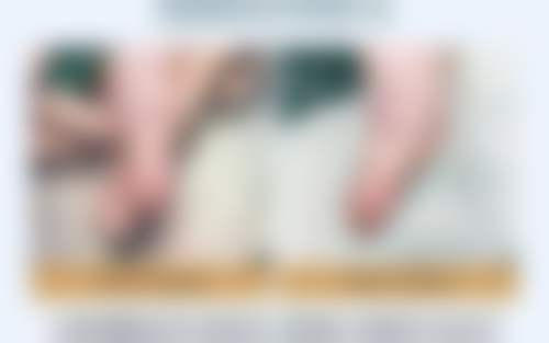 深圳宝安区人民医院医疗美容科地址电话、营业时间