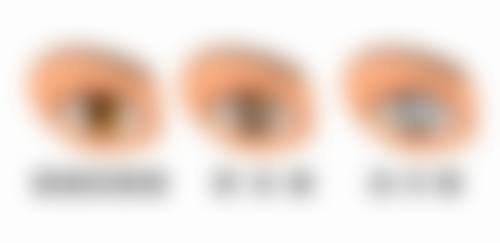 攀枝花市中 心医院李密医生技术优势