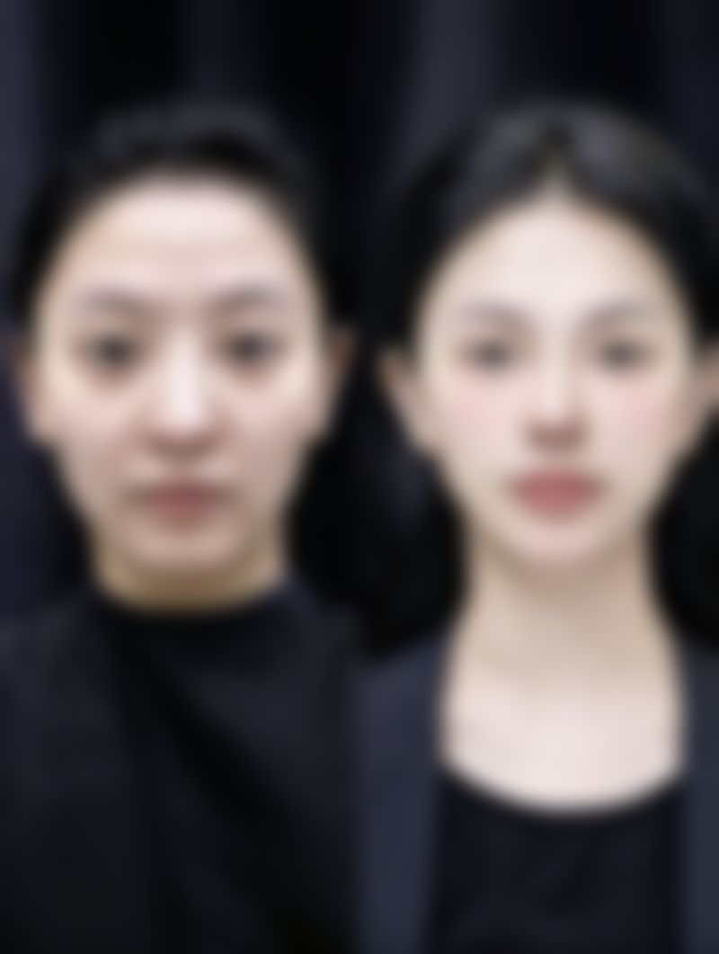 赵庚如医生技术优势