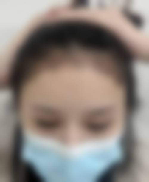 贵阳中医皮肤病医院植发中 心特色诊疗项目与技术优势