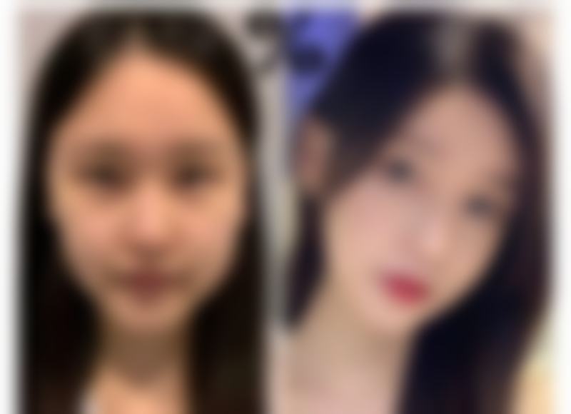 南宁拉斐尔医疗美容外科诊所收费价格表