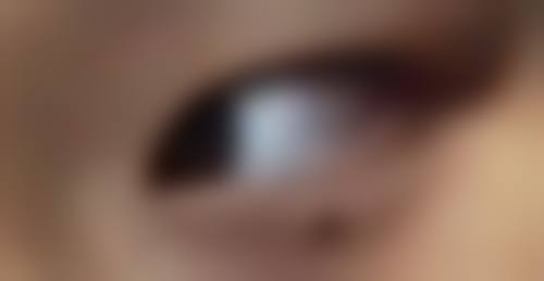 武汉市中 心医院吴方毅医生项目收费价格