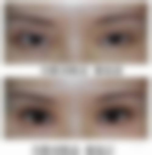 张中锋医生技术优势