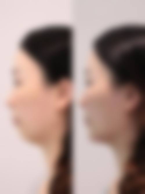 张中锋医生项目收费价格