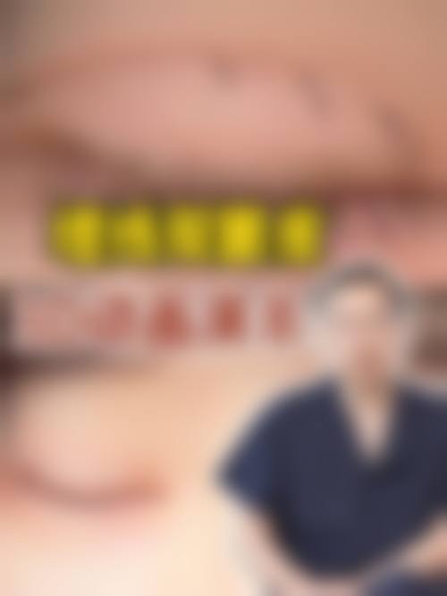 张中锋医生口碑评价及反馈内容