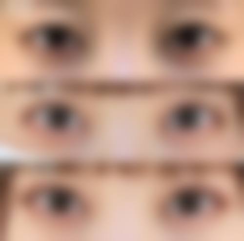 张中锋医生预约挂号