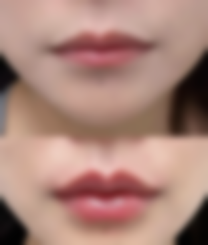 闫德雄医生技术优势