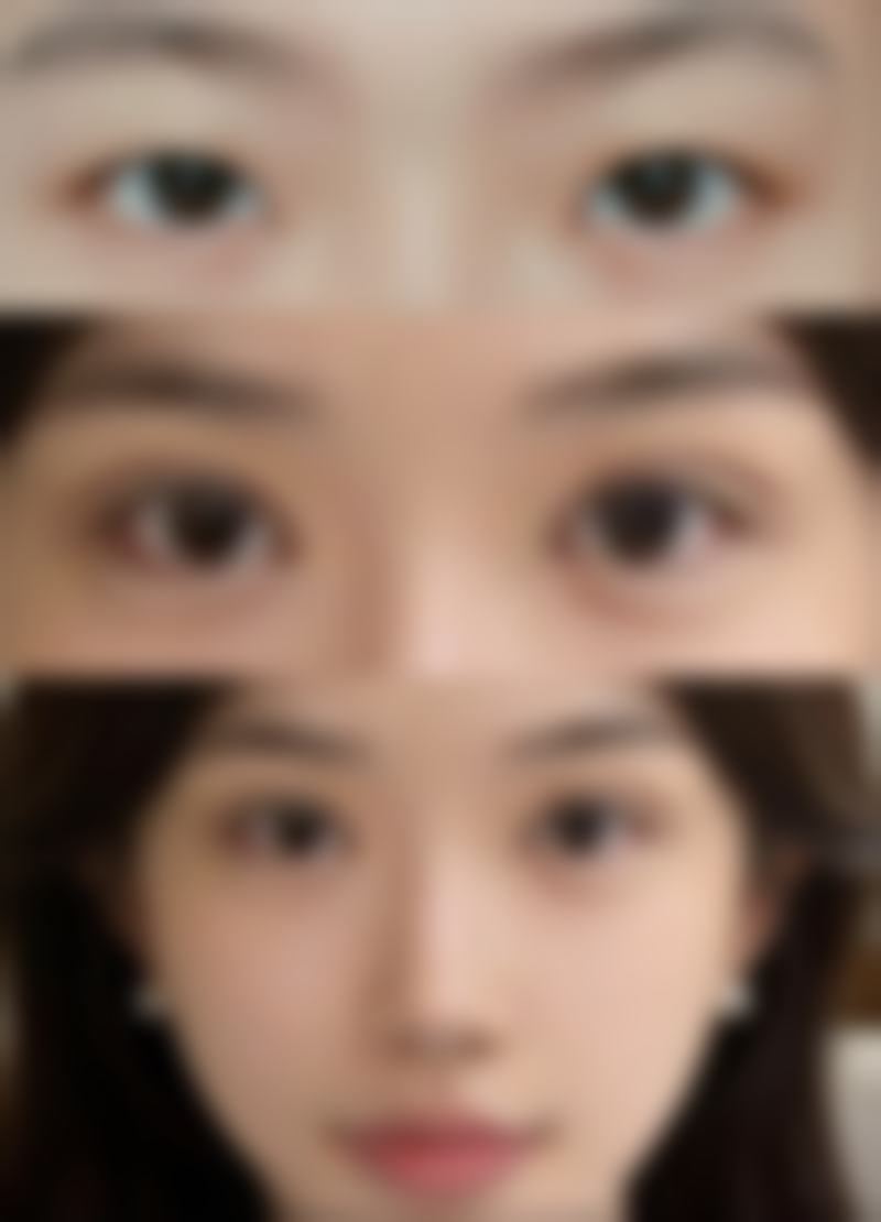 韩国乔颜思(chois)皮肤美容医院特色诊疗项目与技术优势