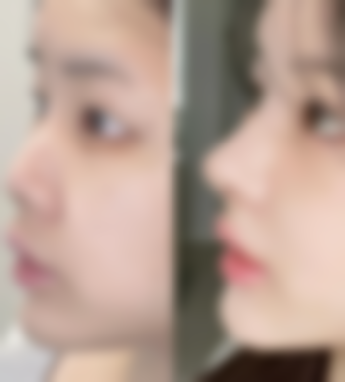 重庆郑荃丽格青春医美门诊部收费价格表