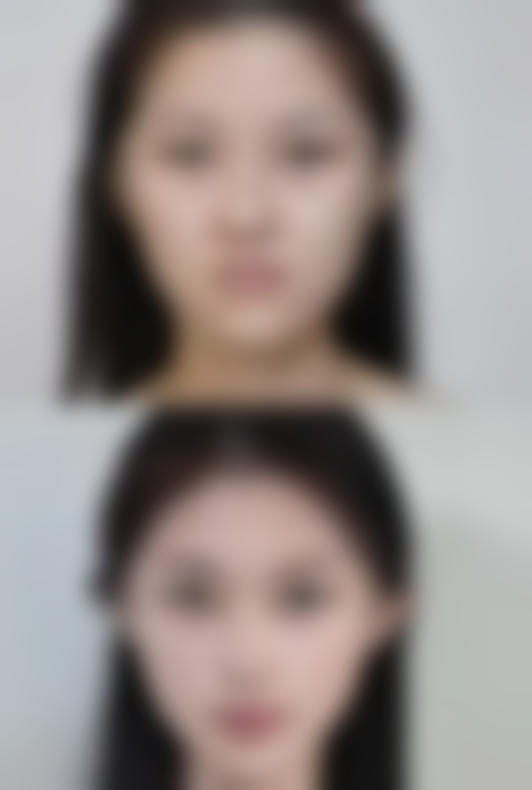 闫德雄医生项目收费价格