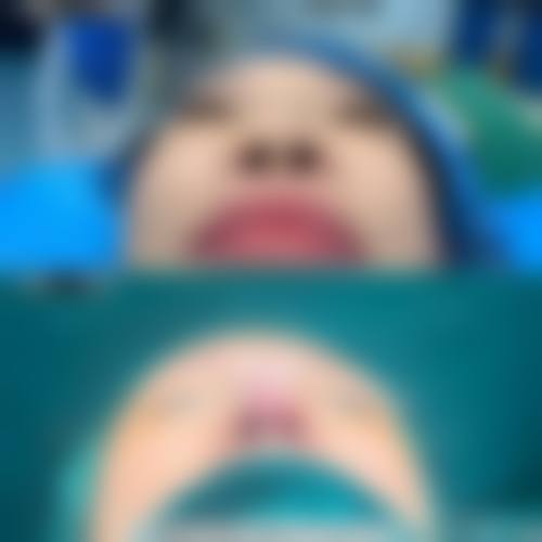 合肥韩宫整形预约挂号方式