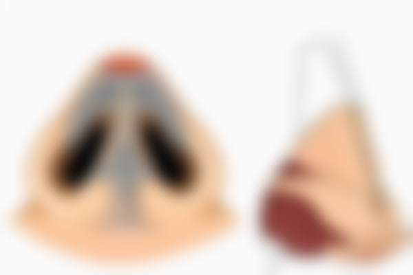 张兵医生技术优势