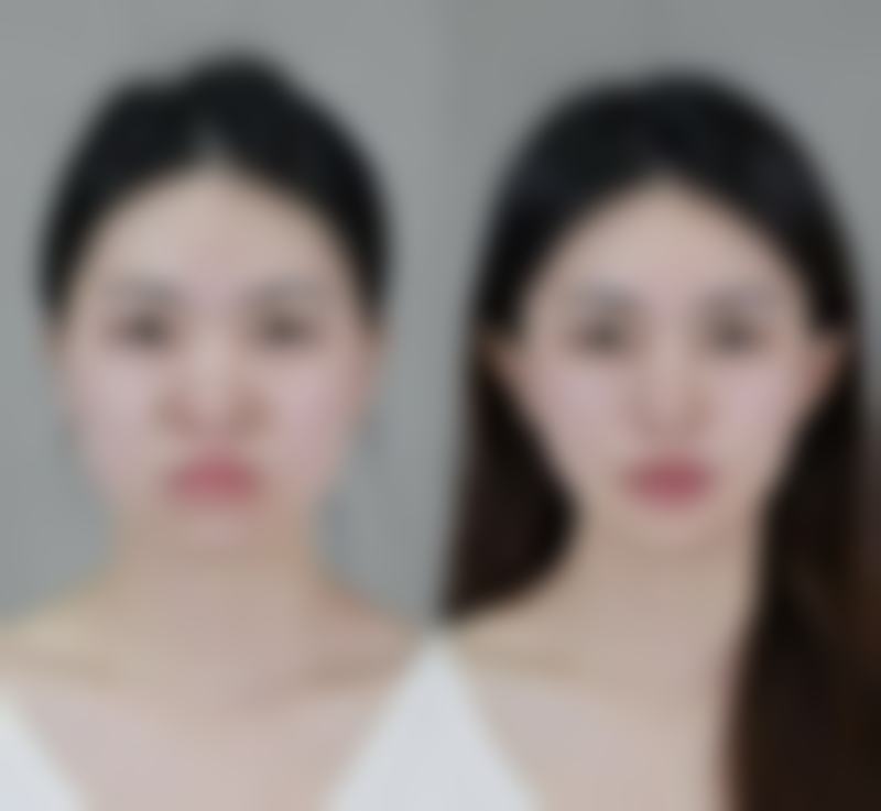 合肥韩宫整形收费价格表