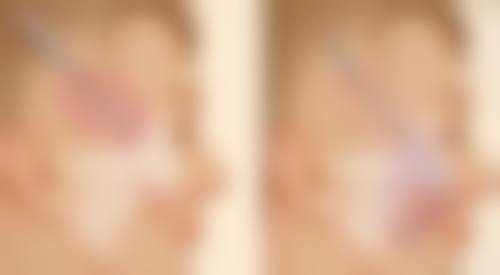 何林燕医生技术优势