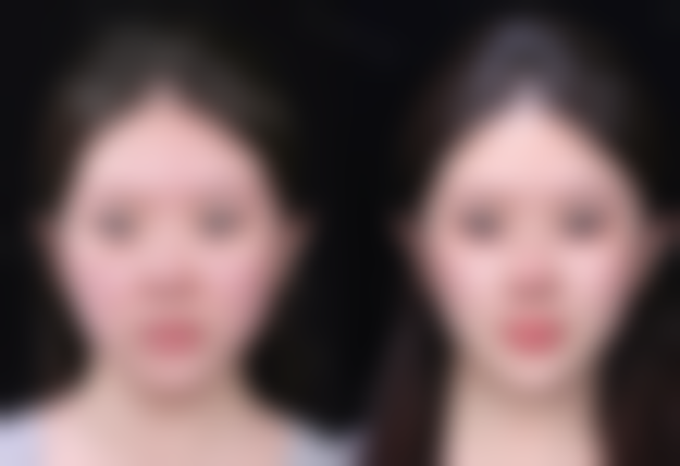 深圳多美美诺医美预约挂号方式