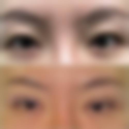 钟雷医生预约挂号