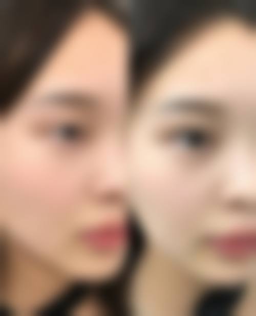 钟雷医生技术优势