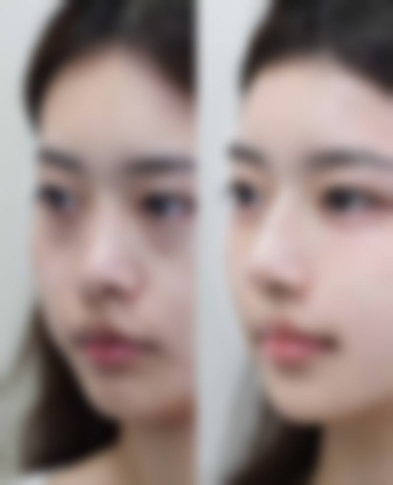 毕节市七星关爱侈医疗美容门诊部收费价格表