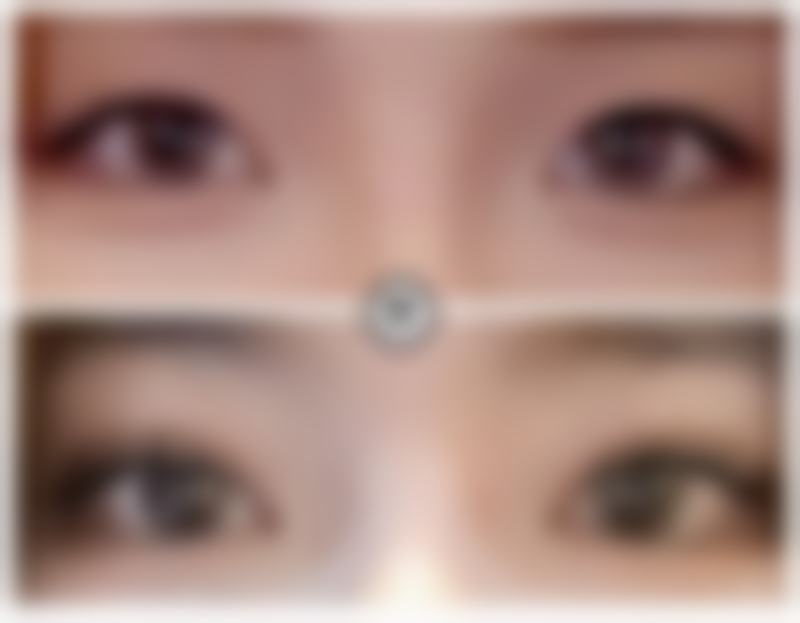 株洲芊丽医疗美容门诊部收费价格表