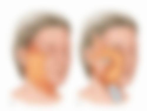 刘海燕医生技术优势