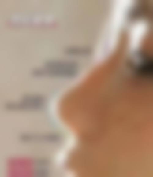 枣庄西子华铭整形医院收费价格表