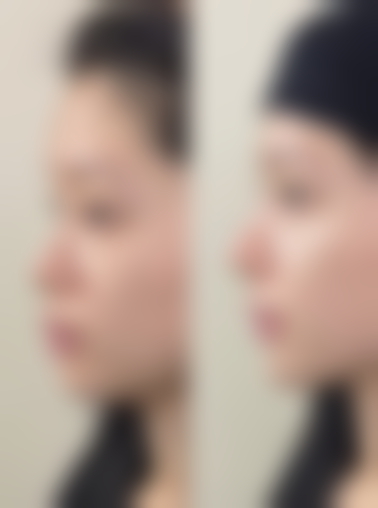 LECINQ 皮肤科诊所收费价格表