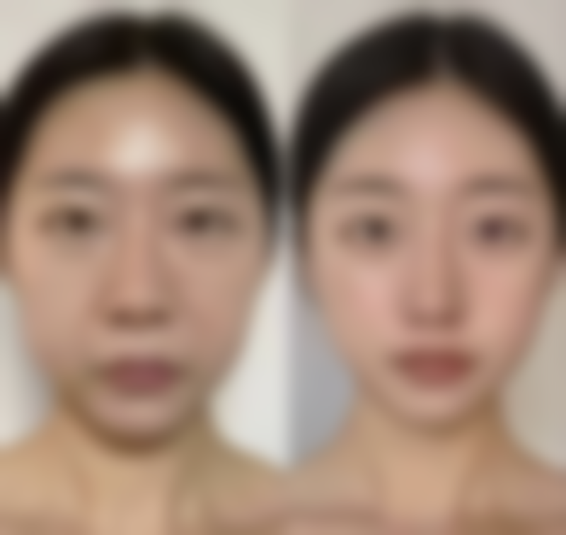 朱万春医生项目收费价格