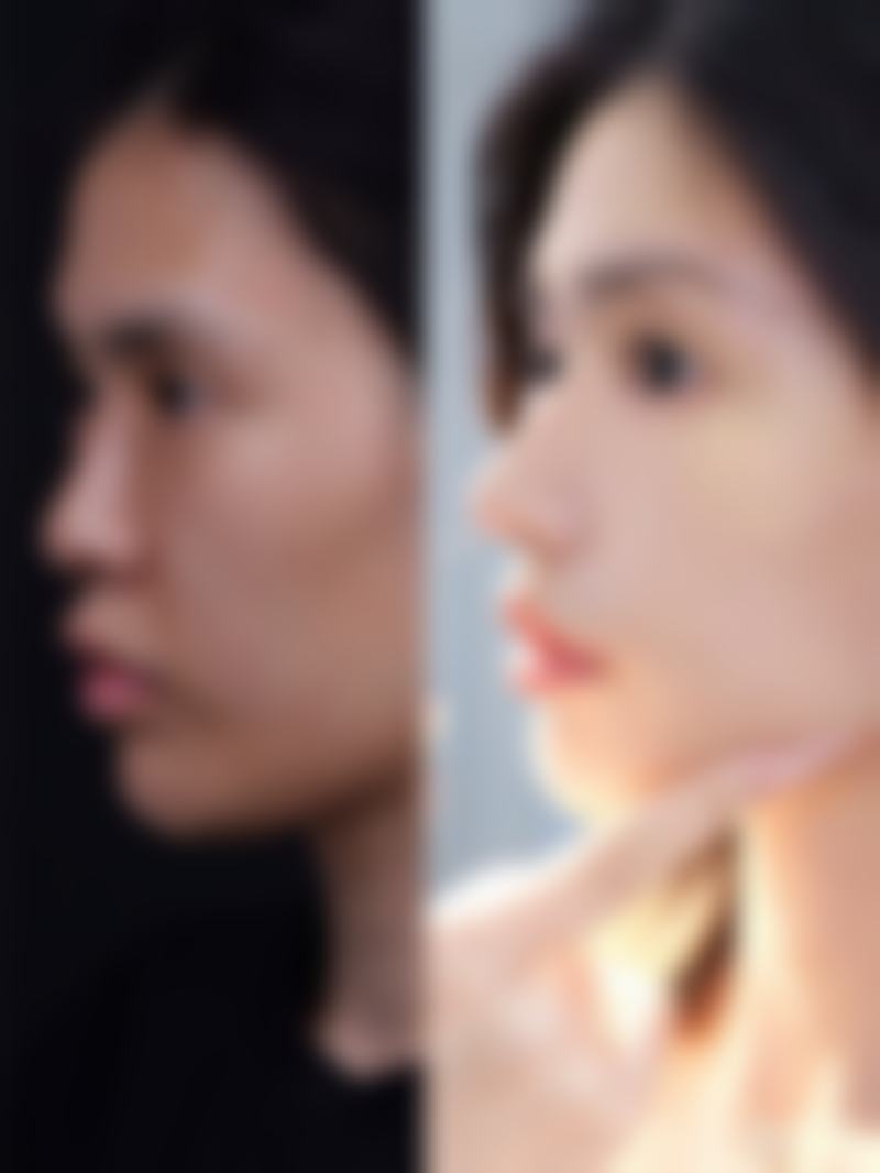 吉林市美辰整形美容医院预约挂号方式