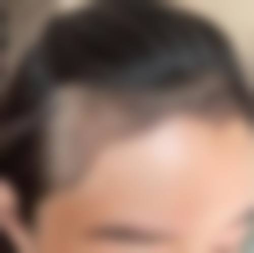 泉州东湖整形美容医院预约挂号方式