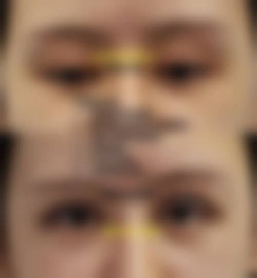 彭忍医生项目收费价格