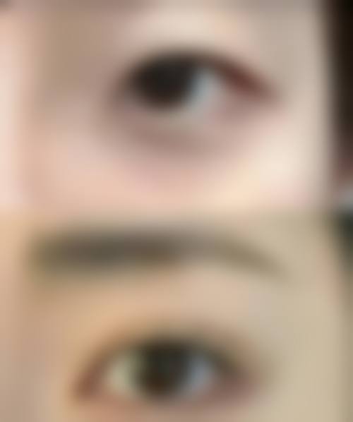 张中锋医生技术优势