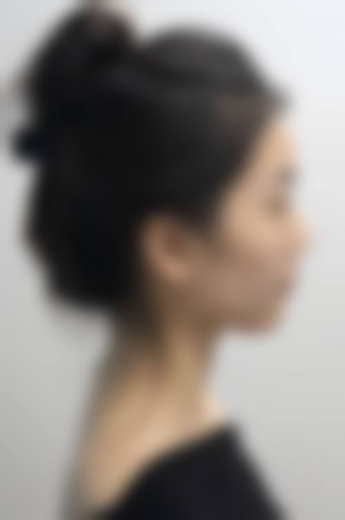 张中锋医生项目收费价格