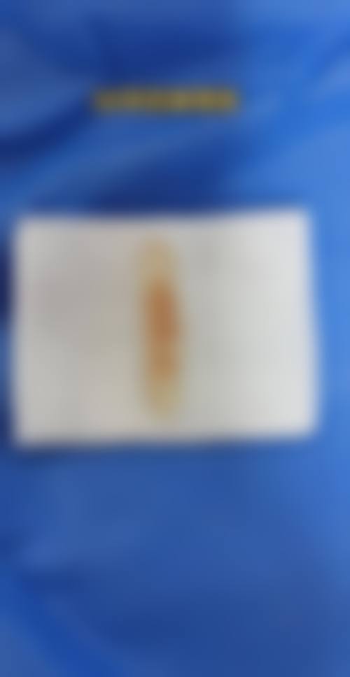 张中锋医生口碑评价及反馈内容